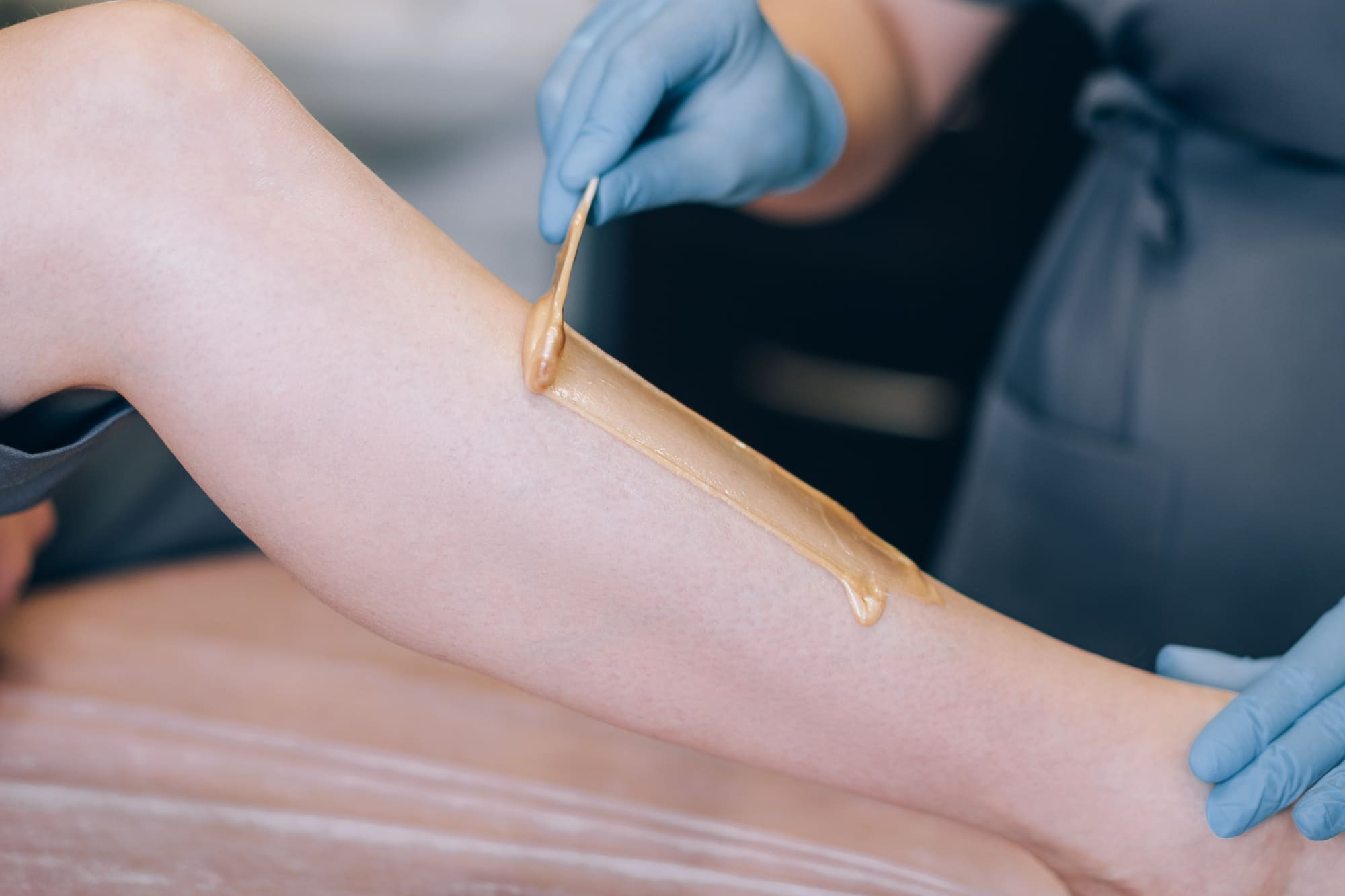 ΑΠΟΤΡΙΧΩΣΗ