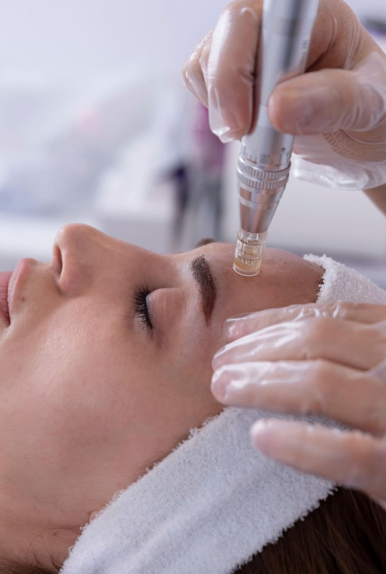 ΜΕΣΟΘΕΡΑΠΕΙΑ